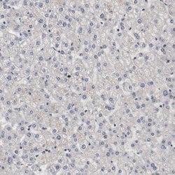Invitrogen WDHD1 Polyclonal Antibody 100 &mu;L | Buy Online | Invitrogen&trade; | Fisher Scientific