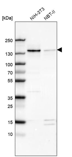 Invitrogen WDHD1 Polyclonal Antibody 100 &mu;L | Buy Online | Invitrogen&trade; | Fisher Scientific