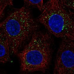 Invitrogen PTGR2 Polyclonal Antibody 100 &mu;L | Buy Online | Invitrogen&trade; | Fisher Scientific