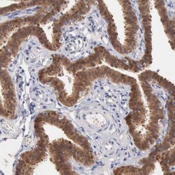 Invitrogen PTGR2 Polyclonal Antibody 100 &mu;L | Buy Online | Invitrogen&trade; | Fisher Scientific