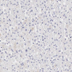 RNase1 Polyclonal Antibody:Antibodies, Polyclonal