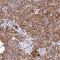 RNase1 Polyclonal Antibody:Antibodies, Polyclonal