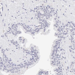 RNase1 Polyclonal Antibody:Antibodies, Polyclonal