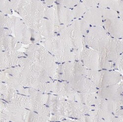 RNase1 Polyclonal Antibody:Antibodies, Polyclonal