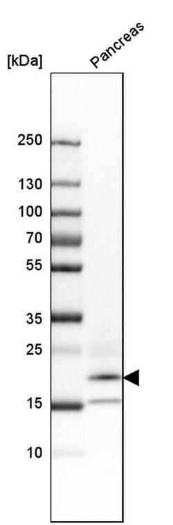 RNase1 Polyclonal Antibody:Antibodies, Polyclonal