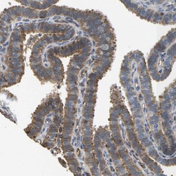 Invitrogen VCPKMT Polyclonal Antibody 100 &mu;L; Unconjugated:Antibodies,