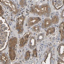 Invitrogen VCPKMT Polyclonal Antibody 100 &mu;L; Unconjugated:Antibodies,