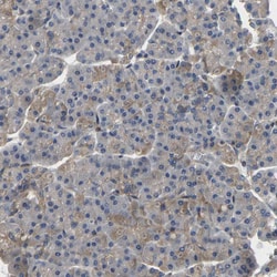 Invitrogen VCPKMT Polyclonal Antibody 100 &mu;L; Unconjugated:Antibodies,