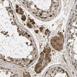 Invitrogen VCPKMT Polyclonal Antibody 100 &mu;L; Unconjugated:Antibodies,