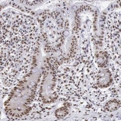 Invitrogen SNRPD3 Polyclonal Antibody 100 &mu;L; Unconjugated:Antibodies,