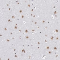 Invitrogen SNRPD3 Polyclonal Antibody 100 &mu;L; Unconjugated:Antibodies,