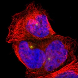 Invitrogen PLA2G6 Polyclonal Antibody 100 &mu;L; Unconjugated:Antibodies,