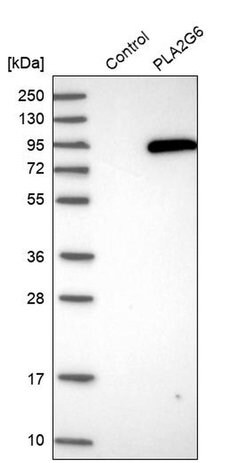 Invitrogen PLA2G6 Polyclonal Antibody 100 &mu;L; Unconjugated:Antibodies,