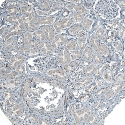 Invitrogen PIGA Polyclonal Antibody 100 &mu;L; Unconjugated:Antibodies,