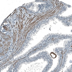 Invitrogen PIGA Polyclonal Antibody 100 &mu;L; Unconjugated:Antibodies,