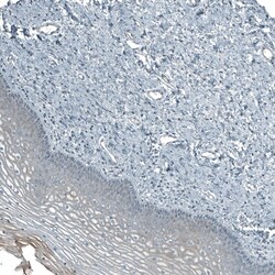 Invitrogen PIGA Polyclonal Antibody 100 &mu;L; Unconjugated:Antibodies,