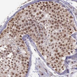 Invitrogen PRPF39 Polyclonal Antibody 100 &mu;L; Unconjugated:Antibodies,