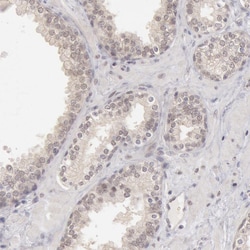 RIMBP3 Polyclonal Antibody:Antibodies, Polyclonal