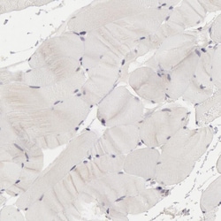 RIMBP3 Polyclonal Antibody:Antibodies, Polyclonal