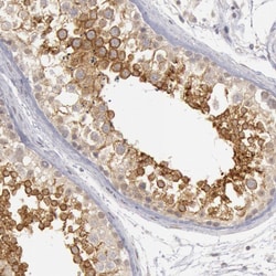 RIMBP3 Polyclonal Antibody:Antibodies, Polyclonal