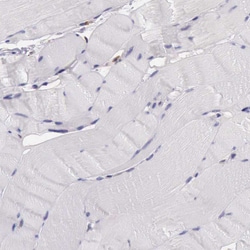 Invitrogen Pleckstrin 2 Polyclonal Antibody 100 &mu;L; Unconjugated:Antibodies,