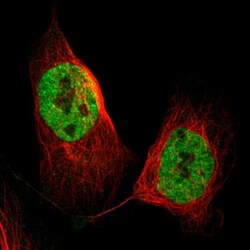 Invitrogen DGCR14 Polyclonal Antibody 100 &mu;L; Unconjugated:Antibodies,