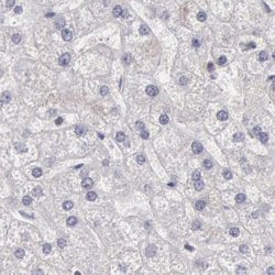 Invitrogen DGCR14 Polyclonal Antibody 100 &mu;L; Unconjugated:Antibodies,