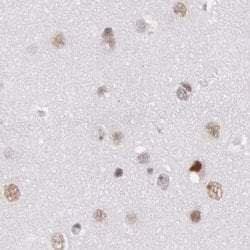 Invitrogen DGCR14 Polyclonal Antibody 100 &mu;L; Unconjugated:Antibodies,