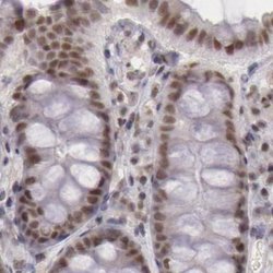 Invitrogen DGCR14 Polyclonal Antibody 100 &mu;L; Unconjugated:Antibodies,