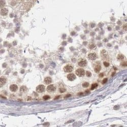 Invitrogen DGCR14 Polyclonal Antibody 100 &mu;L; Unconjugated:Antibodies,