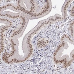 Invitrogen DGCR14 Polyclonal Antibody 100 &mu;L; Unconjugated:Antibodies,