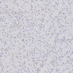 Invitrogen PLOD3 Polyclonal Antibody 100 &mu;L; Unconjugated:Antibodies,