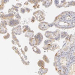 Invitrogen PLOD3 Polyclonal Antibody 100 &mu;L; Unconjugated:Antibodies,