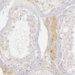 Invitrogen PLOD3 Polyclonal Antibody 100 &mu;L; Unconjugated:Antibodies,