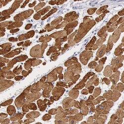Invitrogen MYH7 Polyclonal Antibody 100 &mu;L; Unconjugated:Antibodies,