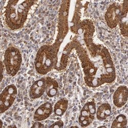 Invitrogen MPST Polyclonal Antibody 100 &mu;L; Unconjugated:Antibodies,