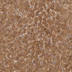 Invitrogen MPST Polyclonal Antibody 100 &mu;L; Unconjugated:Antibodies,