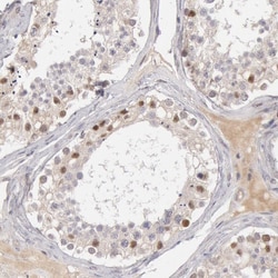 RGAG1 Polyclonal Antibody:Antibodies, Polyclonal