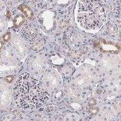 RGAG1 Polyclonal Antibody:Antibodies, Polyclonal