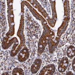 Invitrogen Cytochrome C1 Polyclonal Antibody 100 &mu;L; Unconjugated:Antikörper