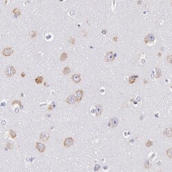 Invitrogen CIDEB Polyclonal Antibody 100 &mu;L; Unconjugated:Antibodies,