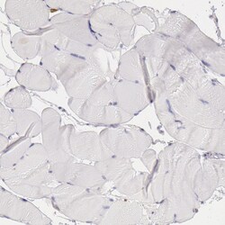 Invitrogen CIDEB Polyclonal Antibody 100 &mu;L; Unconjugated:Antibodies,