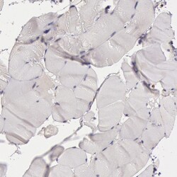 Invitrogen NMT2 Polyclonal Antibody 100 &mu;L; Unconjugated:Antibodies,