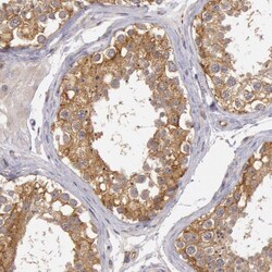 Invitrogen NMT2 Polyclonal Antibody 100 &mu;L; Unconjugated:Antibodies,
