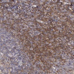 Invitrogen NMT2 Polyclonal Antibody 100 &mu;L; Unconjugated:Antibodies,