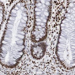 Invitrogen PC4 Polyclonal Antibody 100 &mu;L; Unconjugated:Antibodies,