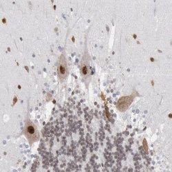 Invitrogen PC4 Polyclonal Antibody 100 &mu;L; Unconjugated:Antibodies,
