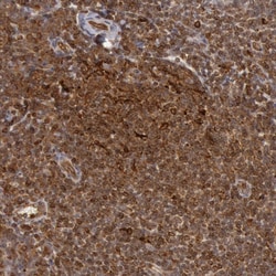 Invitrogen TAP2 Polyclonal Antibody 100 &mu;L; Unconjugated:Antibodies,