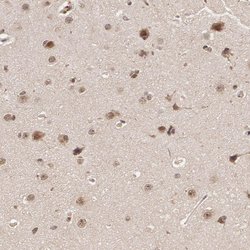 Invitrogen DNA ligase IV Polyclonal Antibody 100 &mu;L; Unconjugated:Antibodies,