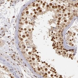 Invitrogen DNA ligase IV Polyclonal Antibody 100 &mu;L; Unconjugated:Antibodies,